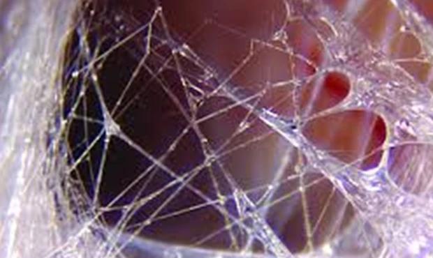 疤痕下筋膜粘连,手术处疤痕下方粘连