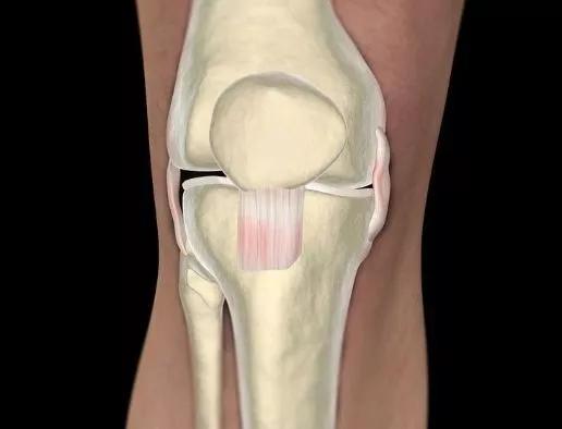 膝盖内侧副韧带损伤总是疼怎么办,膝盖内侧副韧带扭伤怎么处理
