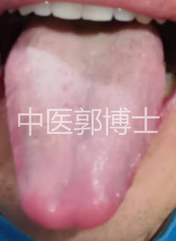 成人咳嗽夜间加重吃什么药,夜间咳嗽肺阴虚吃什么药