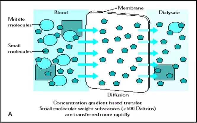 到底是透析好还是换肾好,到底血透好还是腹膜透析好