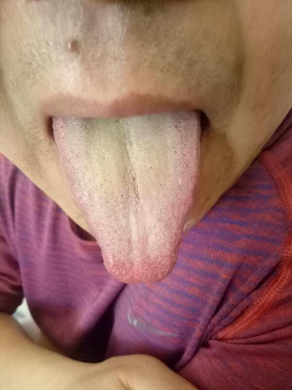 肾虚寒湿证的治法,肾虚湿热症用什么中药调理