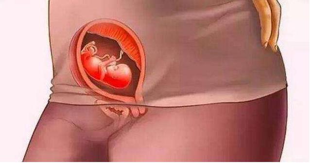 怀胎十月胎儿位置图,怀胎十月婴儿发育全过程