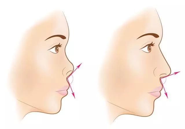 怎么修容把蒜头鼻修成好看的鼻子,鼻子本身就好看怎么修容