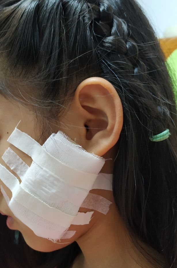 骨髓炎女儿,下颌骨骨髓炎是什么原因引起的