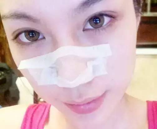 脸颊起皮毛孔粗大怎么护肤,毛孔粗大脸部起皮粗糙怎么改善