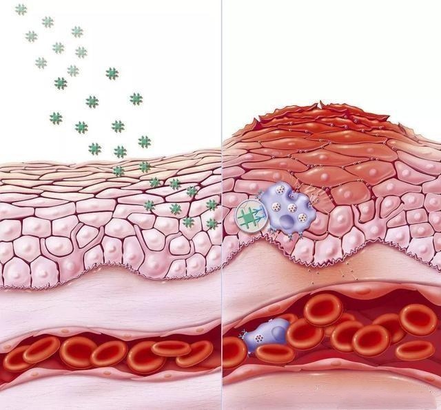 神奇面膜有激素吗,激素依赖皮炎修复面膜