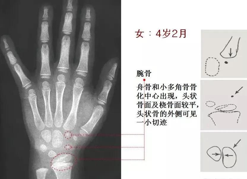 孩子个子高却跑不快,小孩个头不高