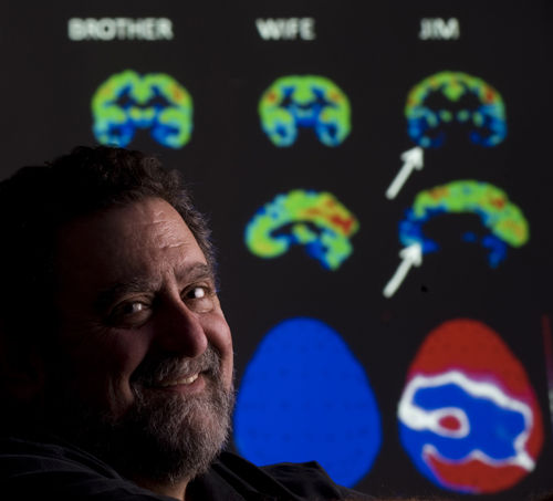 什么是心理变态有哪些表现,心理变态和行为变态有什么区别吗