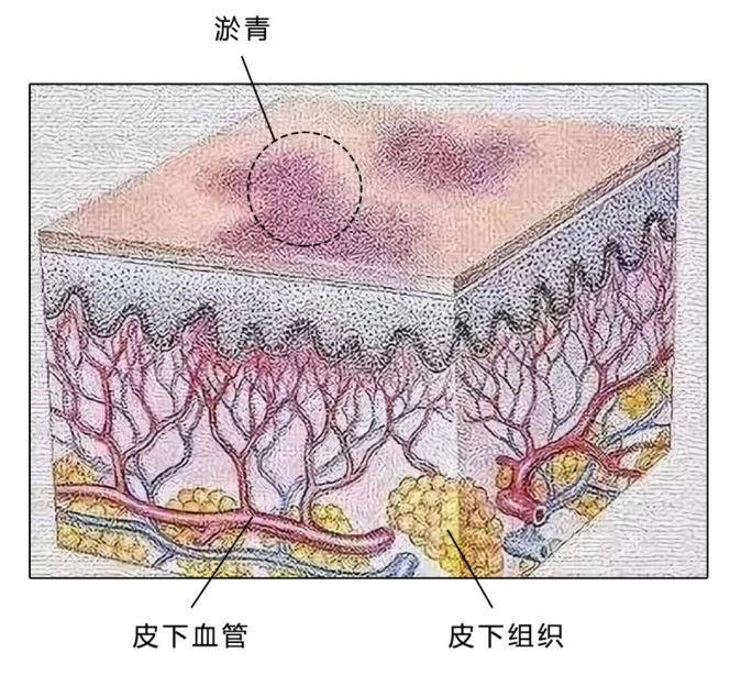 女孩子洗澡水高好还是不好,女孩子洗澡水到底有多烫