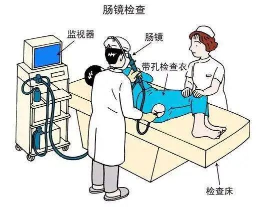 胃镜肠镜检查前的准备,做肠镜检查前做什么准备
