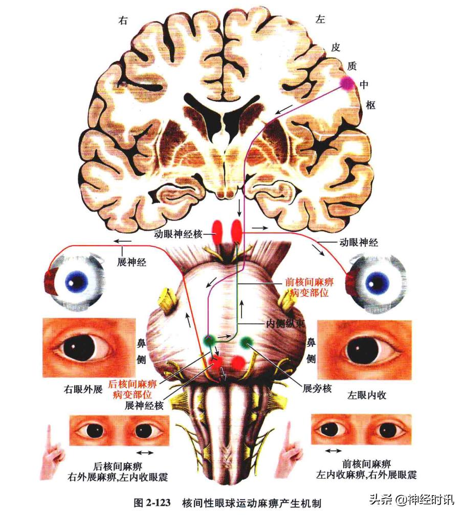 脑干解剖,脑干神经解剖