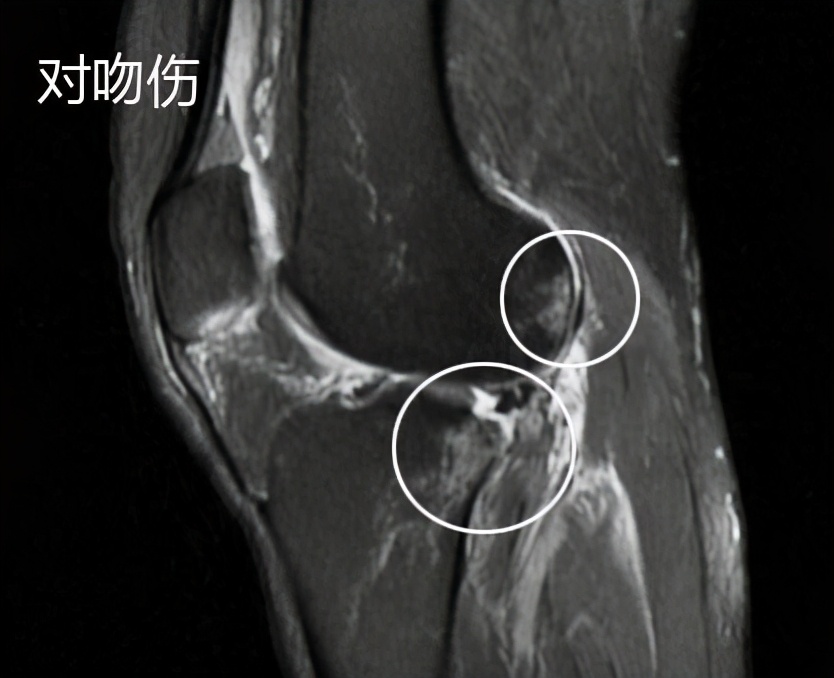 到底是手术好还是保守治疗好,保守治疗和手术治疗怎么选