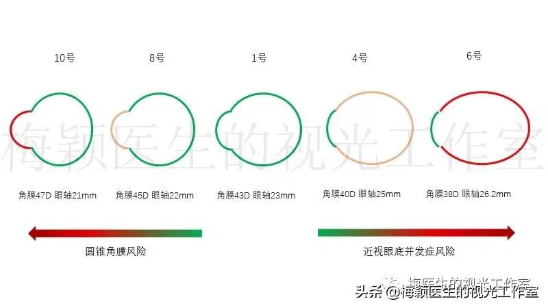 医生说孩子现在还没近视，但眼轴比同龄儿童长了，怎么办？