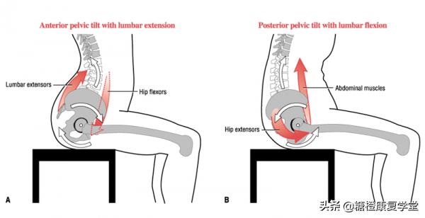 骨盆倾斜与脊柱侧弯还有这种联系？（1）