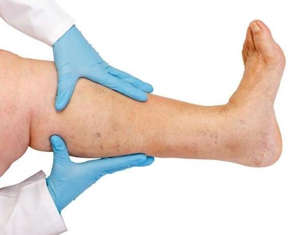 腘静脉血管闭塞腿脚晚上出汗好吗,血管狭窄引起腿脚阵疼吃什么蔬菜