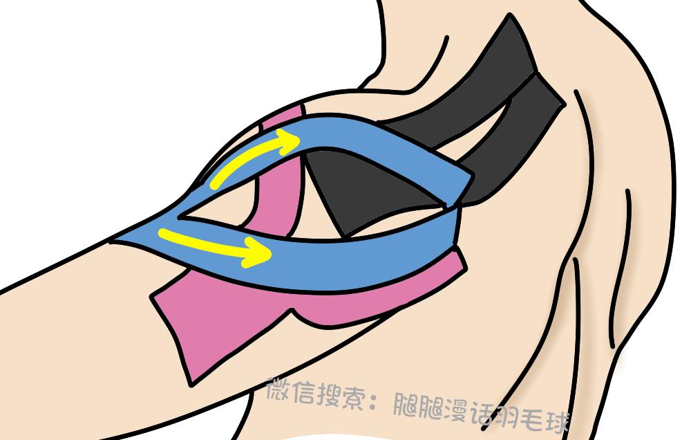 打球后肩膀痛怎么缓解,打球肩膀疼一招搞定