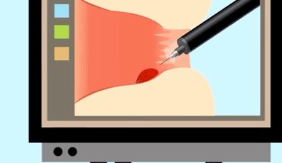 爬着走能治痔疮,睡前一招治痔疮