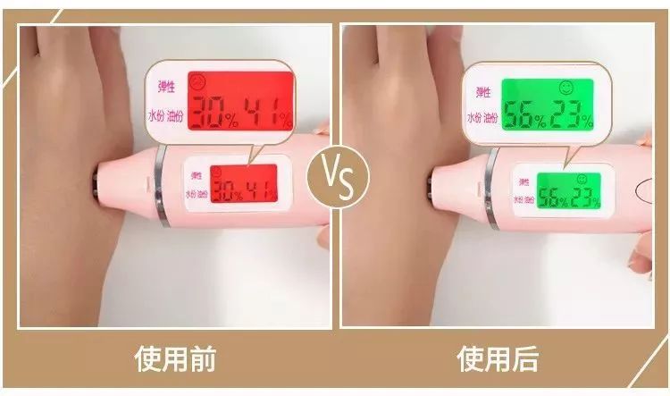 擦手霜保湿干裂起皮,冬季手干裂粗糙小妙招