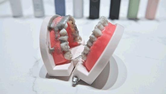 八款智能牙刷评测,8-12岁电动牙刷测评