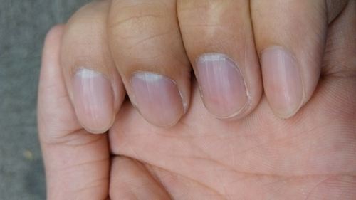 没有妇科问题的女性，手部通常会有这3种特征显现，快来看看