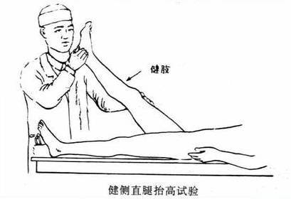 腰椎间盘突出症的临床诊治策略,腰椎间盘突出症的临床诊治