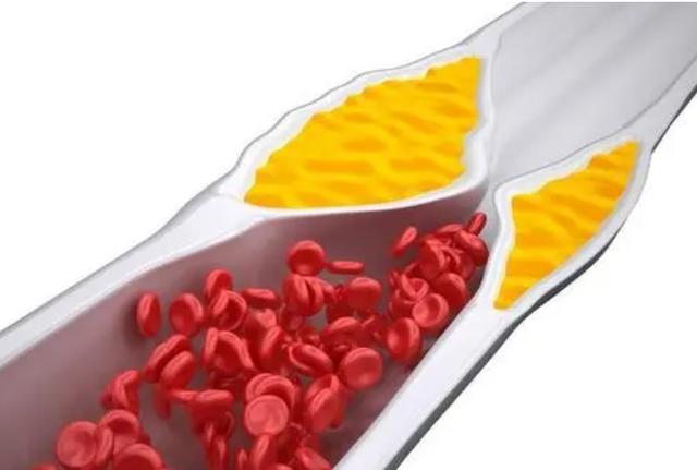 经常吃核桃对身体有什么好处,长期吃核桃的好处和坏处