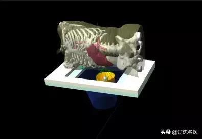 巨块肝癌最新治疗方法,肝癌介入治疗方法