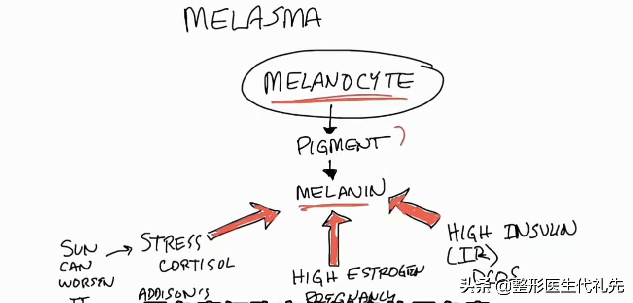 褐斑成因,褐斑的形成原因和治疗方法