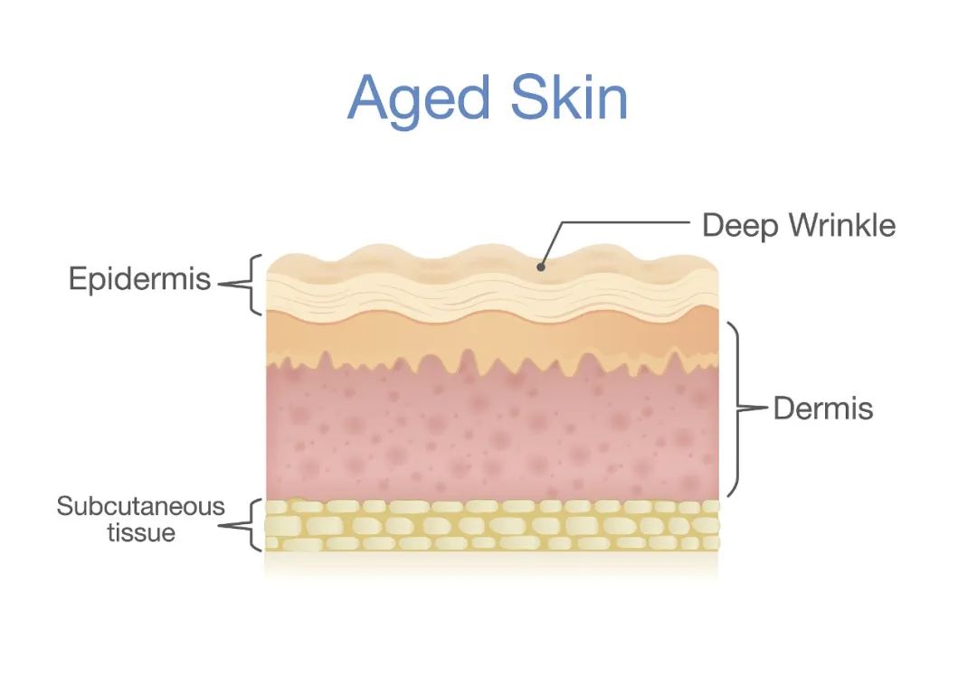 抬头纹法令纹可以用护肤品消除吗,抬头纹法令纹鱼尾纹克星能管用吗
