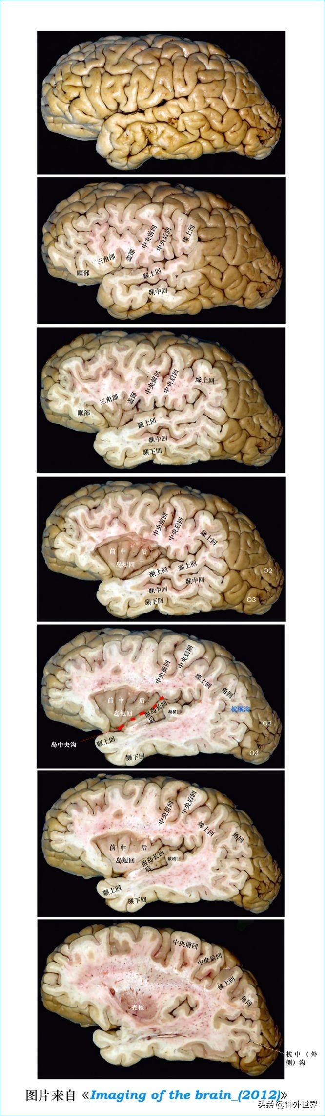 脑解剖学讲解视频全集,脑功能解剖学习