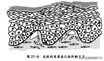 为啥会过敏什么原因导致的,酒精过敏怎样改善过敏体质