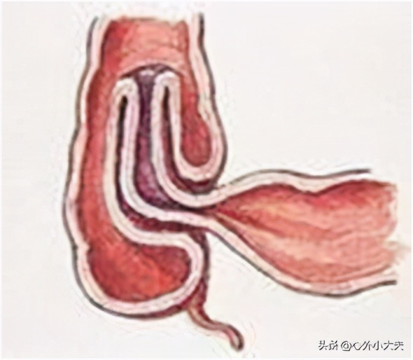 小儿外科常见疾病有哪些,儿童常见的外科疾病有哪些