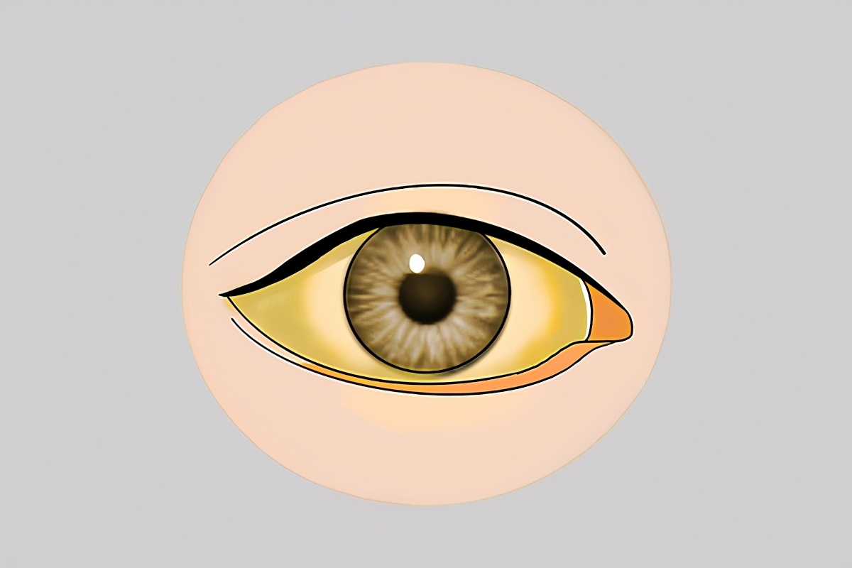 乙肝身体恶化吃什么药,乙肝恶化面部红斑点