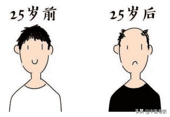 男性脂溢性脱发可以用生姜擦吗,脱发秃头用什么擦好