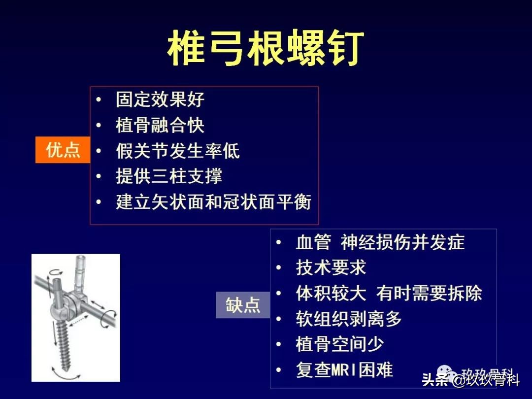 腰椎不稳最坏的结果,腰椎不稳的最佳治疗方法
