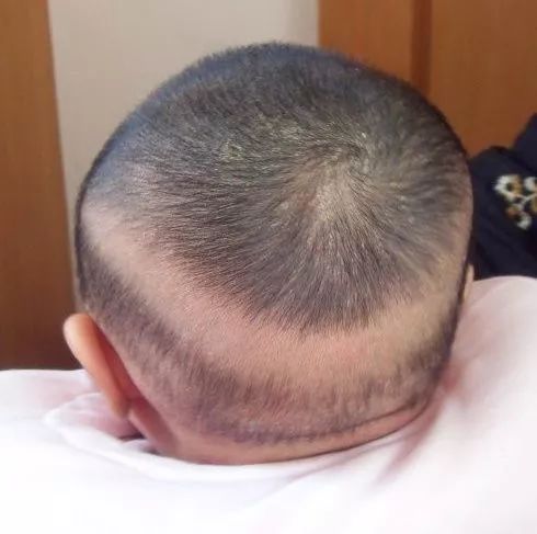 宝宝一吃就拉粑粑是什么原因,宝宝一吃就拉粘液