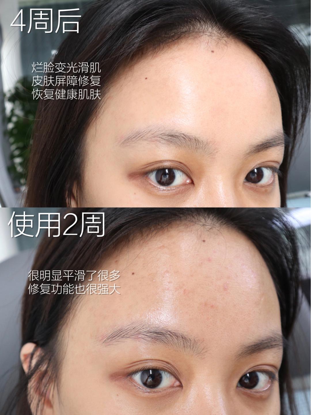 还过儿童节呢?25岁就开始“抗初老”了!这4款别说你一个没用过