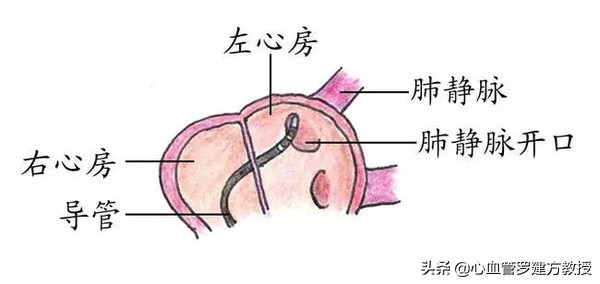 发生心律不齐，怎么样才能恢复正常？#原创首发##青云计划#