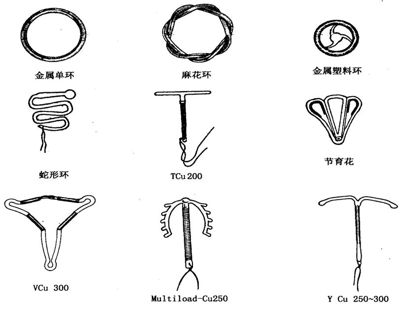 “上环”避孕这11个问题要知道,科学避孕,别让“误区”害了你