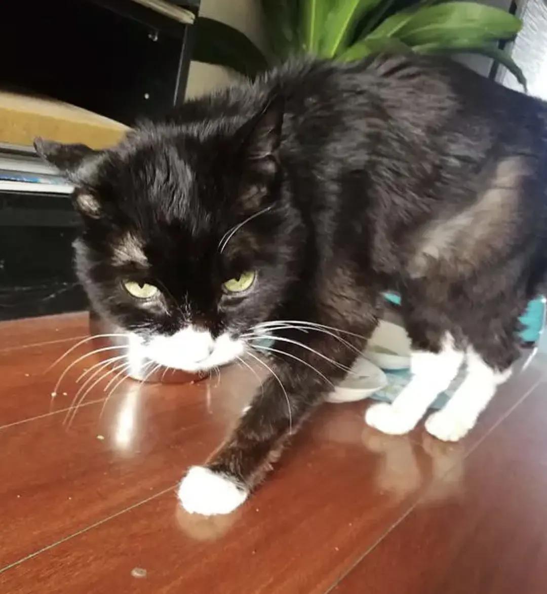 糖尿病患者胆囊炎胰腺炎同时出现,胆囊结石胰腺炎糖尿病