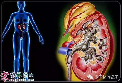 泌尿外科一些常见有用的精华知识