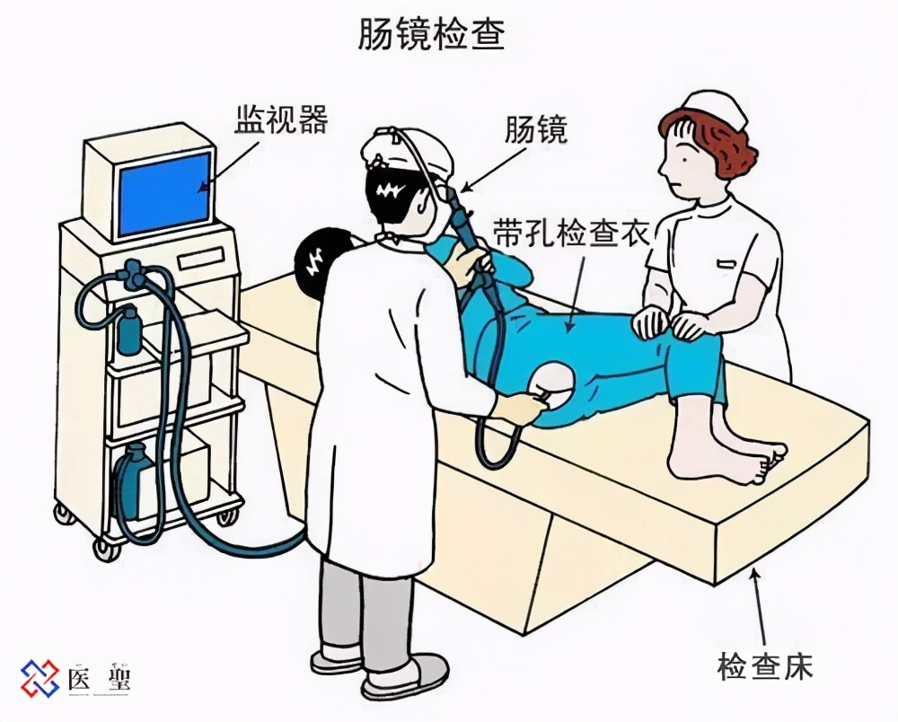 iseihealth:为什么即使在绝经后，每年的检查也是必要的