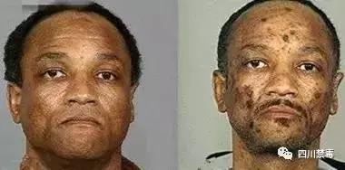 真实的吸毒者有多恐怖,吸毒后的恐怖事件