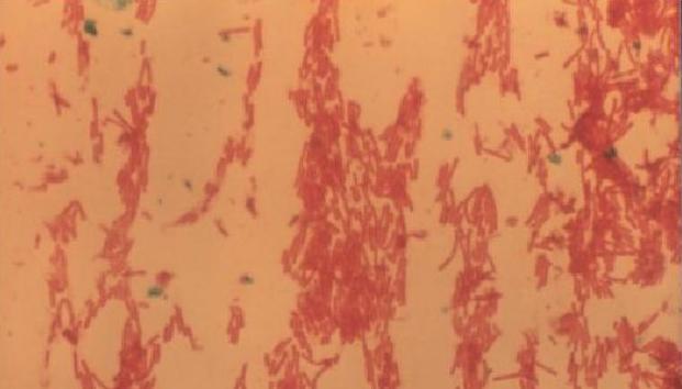 猪水疱病与猪口蹄疫的区别,猪水疱病和口蹄疫的区别