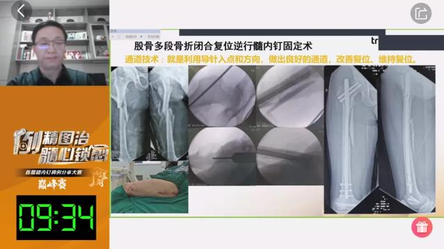 宁武县医疗集团人民医院曹丽东在“全国首届髓内钉病例分享大赛”中荣获季军