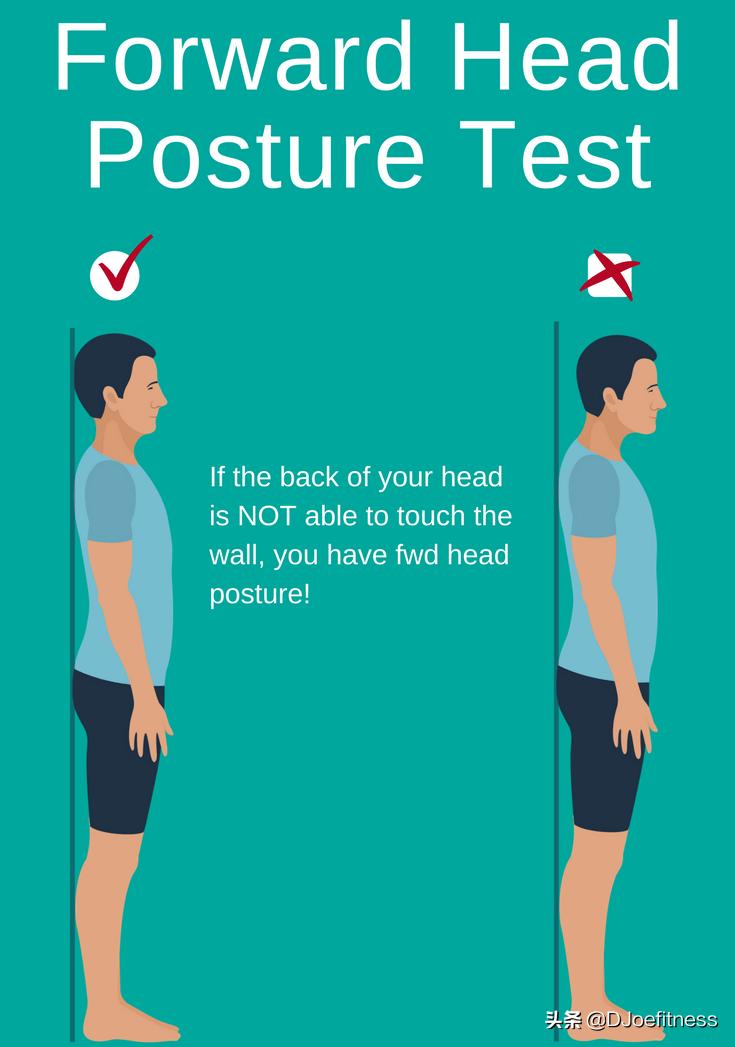 颈椎骨前倾怎么矫正,颈椎前倾的康复治疗方法