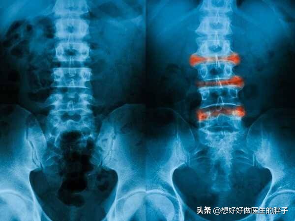 背部内侧疼痛怎么解决男性,年轻男性右侧背部疼痛