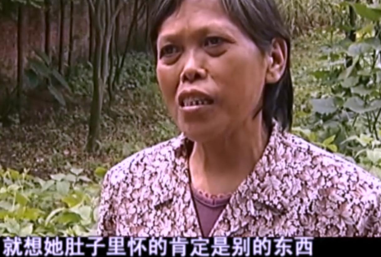 2007年四川90岁老妇，腹中怀子60年未生，后检查发现胎儿没有腐烂