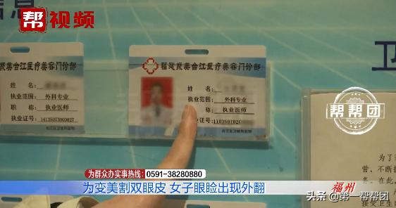 为了美整容整形的失败案例,90后割双眼皮亲身经历