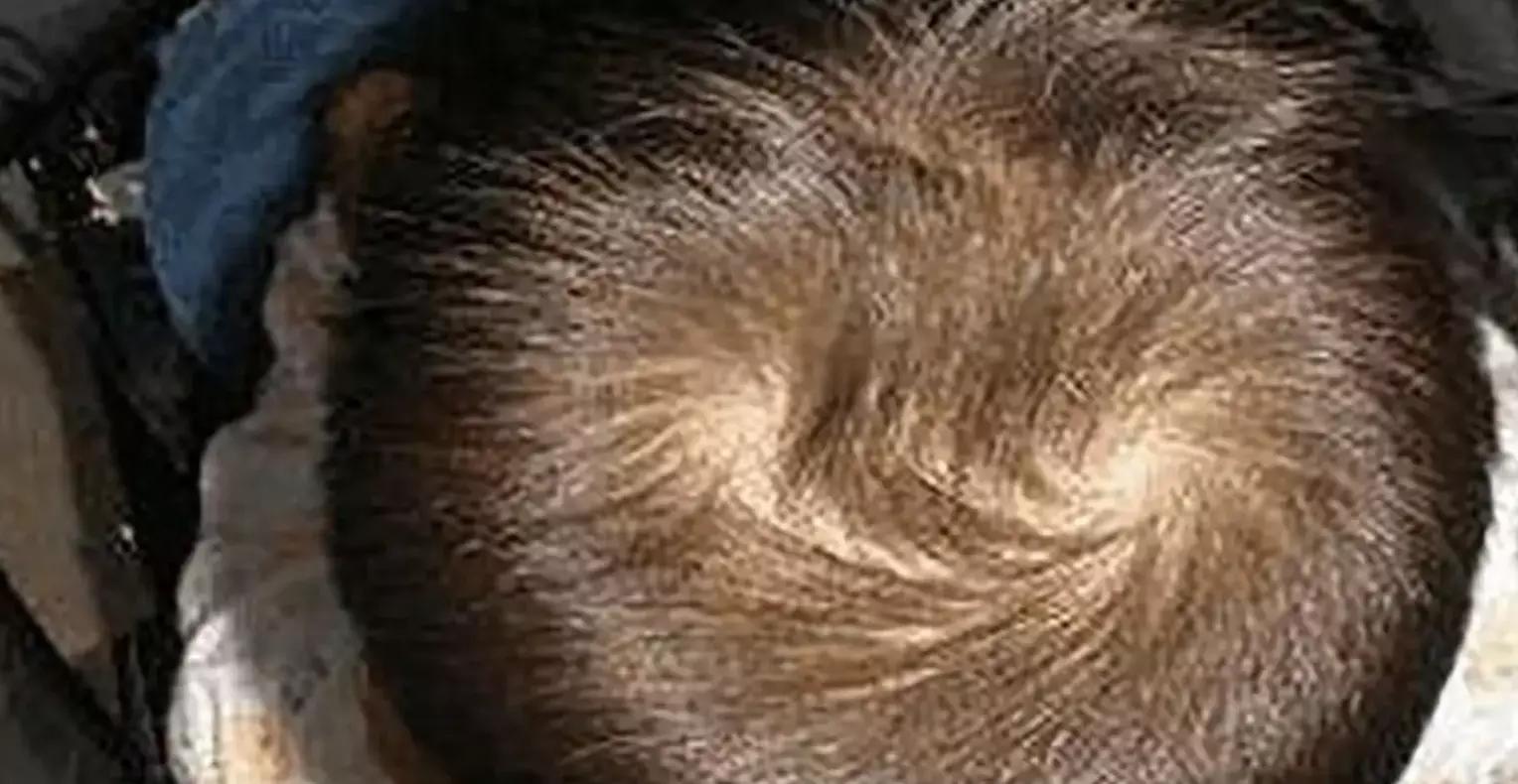 家庭教育对婴儿大脑的影响,宝宝摔倒后脑勺着地会影响智力吗